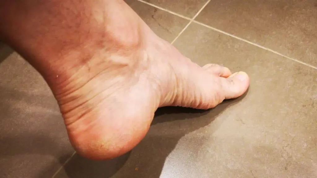 4 - a picture of foot on tiles